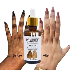 GMPC Bodycare Cosmetics Whitening Hand Knuckle Glow Serum สำหรับการลบข้อศอกข้อศอกดำ