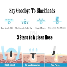 500ml OEM ผลิตภัณฑ์ดูแลผิว สิว รูขุมขนหยาบ ร้านเสริมสวย Blackheads Liquid Remover สำหรับจมูก