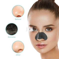 OEM ผลิตภัณฑ์ดูแลผิว 5 ชิ้น Deep Cleansing Bye Bye แถบจมูกกำจัดสิวหัวดำ