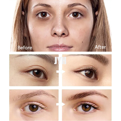 ODM Pro Xylane Eye Cream สำหรับขอบตาคล้ำและอาการบวม ปรับแต่งได้