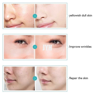 Apple Stem Cell Wrinkle Removal Serum Antioxidant Serum สำหรับผิวแพ้ง่าย