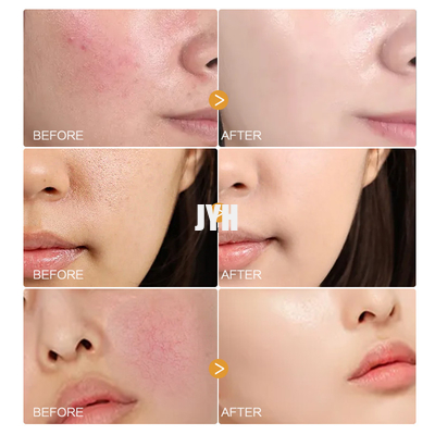 MSDS ผลิตภัณฑ์บำรุงผิวหน้า Organic Chamomile Petals Serum เซรั่มบำรุงผิวหน้าธรรมชาติสำหรับผิวบอบบาง