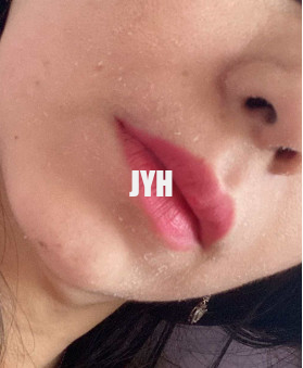 10% Glycolic Acid Hydrating Facial Toner 100ml Skincare Chemical Peel ผิวกระจ่างใส