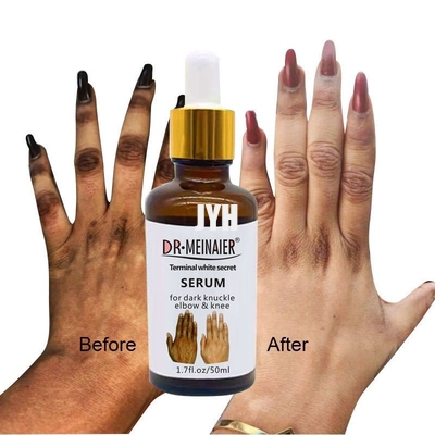 GMPC Bodycare Cosmetics Whitening Hand Knuckle Glow Serum สำหรับการลบข้อศอกข้อศอกดำ