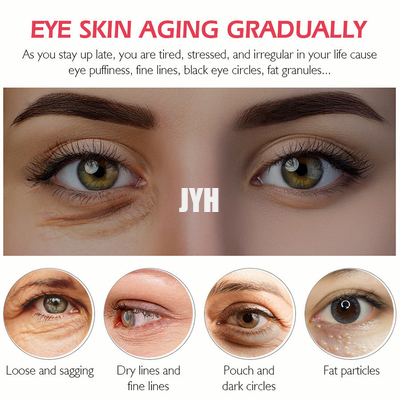 20g Eyecare Cosmetics โปรตีนกระชับและลดน้ำหนักริ้วรอยรอบดวงตาให้ความชุ่มชื้น
