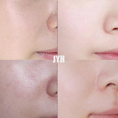 30g Ultimate Spot Cream Acne Treatment ครีมปรับผิวกระจ่างใสและซ่อมแซมใบหน้า