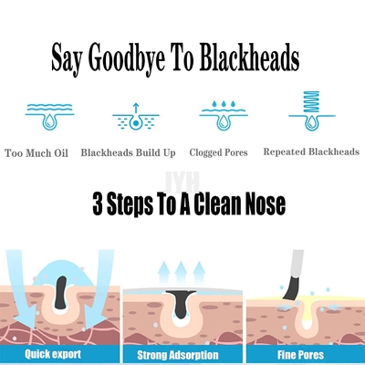 500ml OEM ผลิตภัณฑ์ดูแลผิว สิว รูขุมขนหยาบ ร้านเสริมสวย Blackheads Liquid Remover สำหรับจมูก
