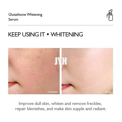 กลูตาไธโอนสกินแคร์ Essence Face Serum ไวท์เทนนิ่ง Anti Aging Freckle Face Serum