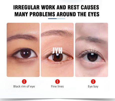 15 มิลลิลิตร สินค้าดูแลผิวหนัง OEM สูตรบํารุงผิวหนัง Anti Aging Eyebag Removal Eye Cream